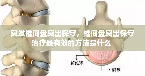 突發(fā)椎間盤突出保守，椎間盤突出保守治療最有效的方法是什么 