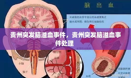 貴州突發(fā)腦溢血事件，貴州突發(fā)腦溢血事件處理 